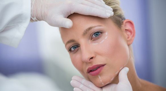 Cirugía plástica 6 Lifting facial en Sevilla